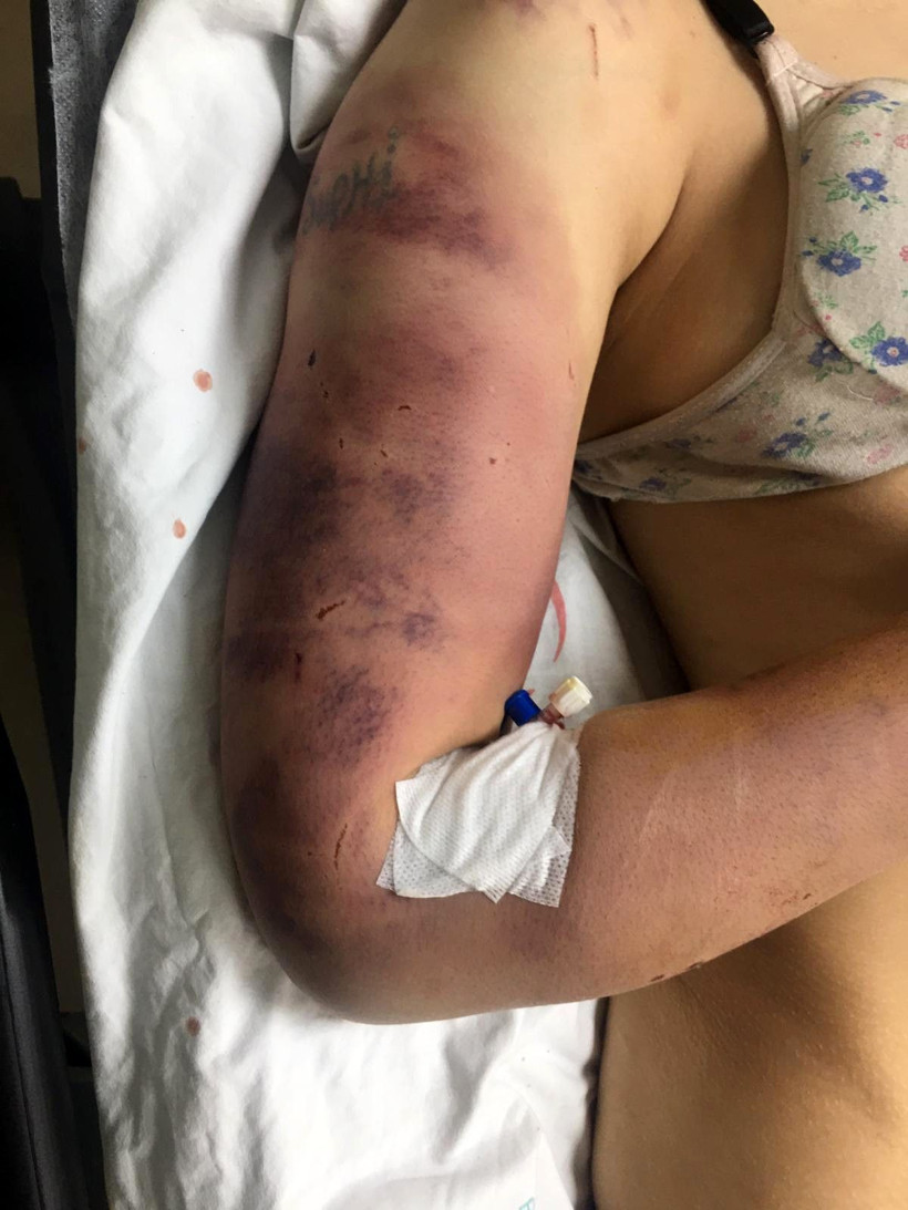 Şanlıurfa'da kan donduran olay! Eşini eve kilitleyip işkence yaptı kerpetenle tırnaklarını söktü - Resim: 2