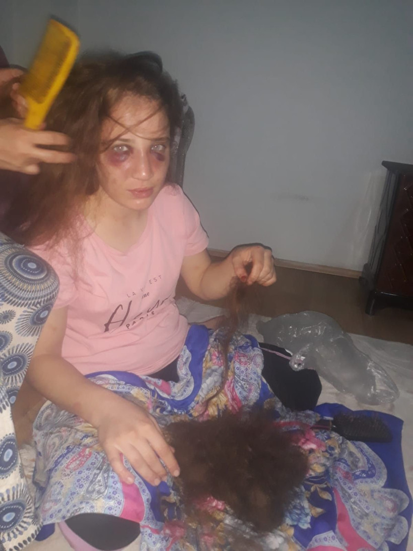 Aydın'da akılalmaz işkence! 3 çocuk annesi kadını bu hale getirdi! - Resim: 1