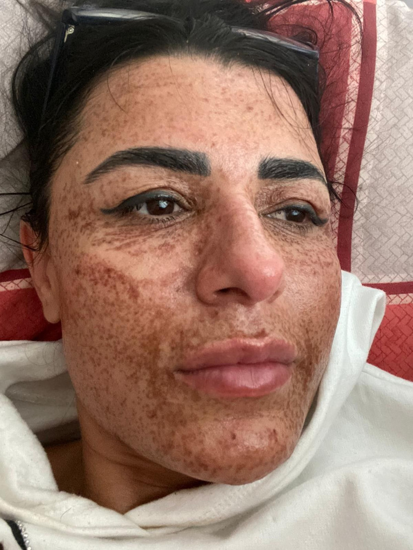 Antalya'da sosyal medyada gördü sadece bir şey istedi! Korkunç hale geldi - Resim: 2