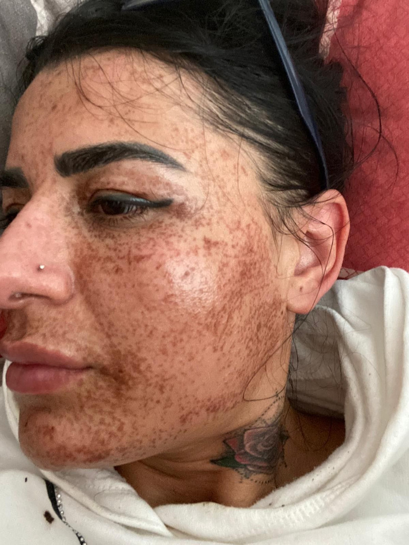 Antalya'da sosyal medyada gördü sadece bir şey istedi! Korkunç hale geldi - Resim: 4