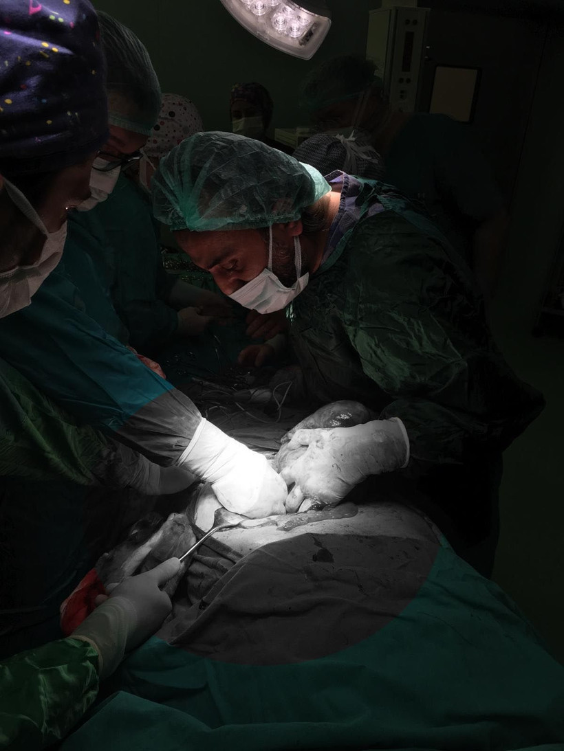 Eskişehir'de ağrıyla gitti karnından 6 kiloluk tümör çıktı - Resim: 2