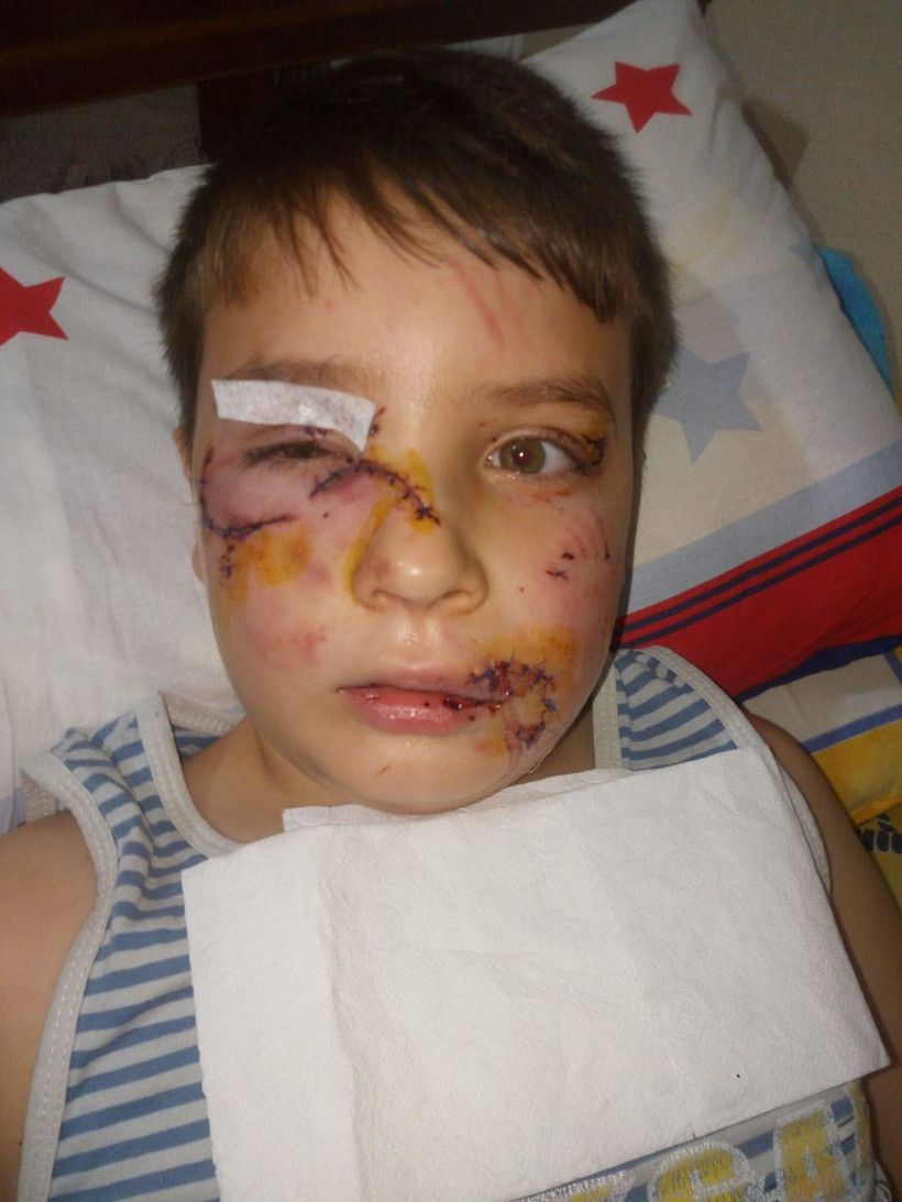 Manisa'da evinin önünde oynayan çocuğa köpek saldırdı 60 dikiş atıldı - Resim: 3