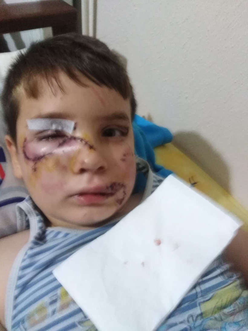 Manisa'da evinin önünde oynayan çocuğa köpek saldırdı 60 dikiş atıldı - Resim: 4