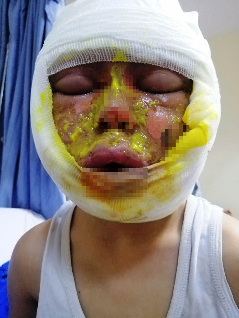 Gaziantep'te oyun korkunç şekilde bitti! Bomba gibi patladı alevler metrelerce yükseldi: Oğlumu tanıyamadım - Resim: 2