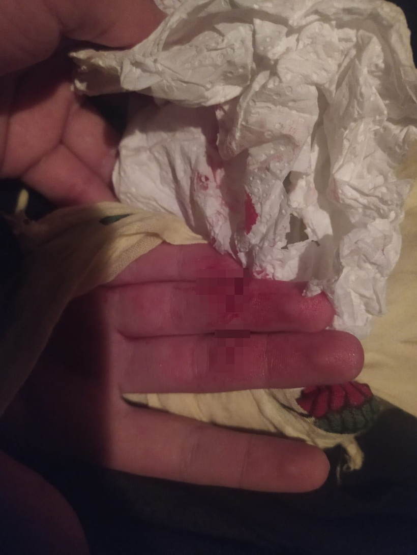 Sapık, 15 yaşındaki kıza asansörde dehşeti yaşattı! Vatandaşın elinden 'sapığı kovalıyorum' diye kaçtı - Resim: 4