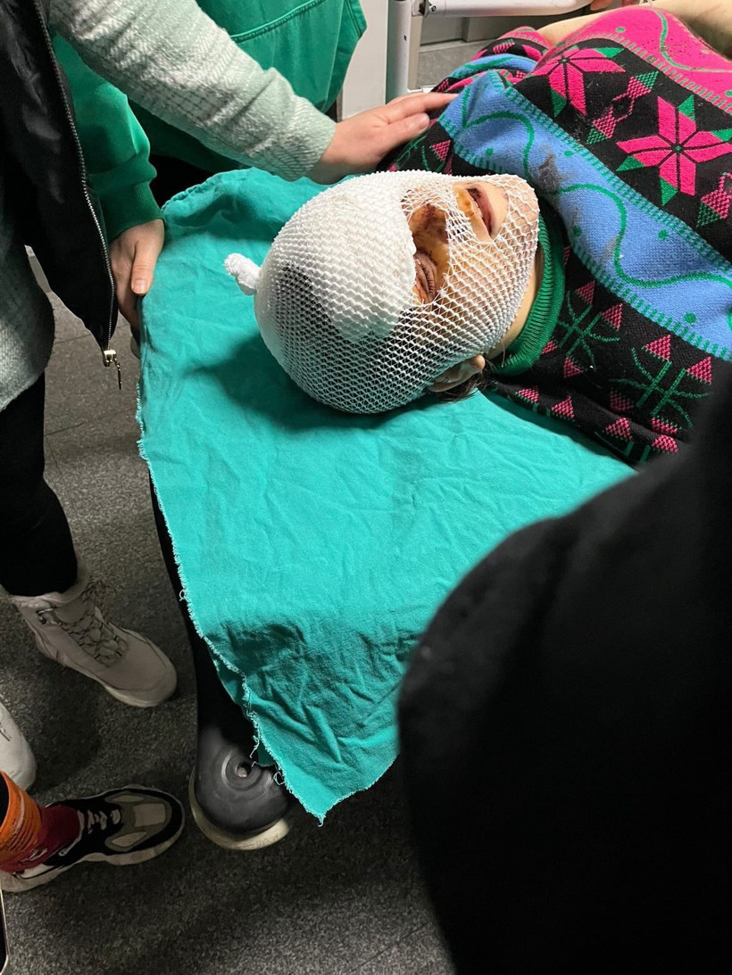 Dini nikahlı eşi sokak ortasında bıçakladı yüzü paramparça olan kadın konuştu - Resim: 2