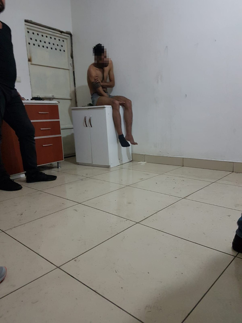 Vücudunda sigara söndürdü ve üstüne limon sıktılar korkunç görüntüler ortaya çıktı - Resim: 2