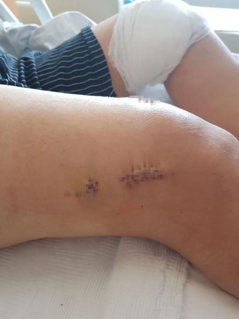 Bir çuval mermi ile öldürmeye geldi! 'Ölmek istemiyorum" diye çığlık attı - Resim: 4