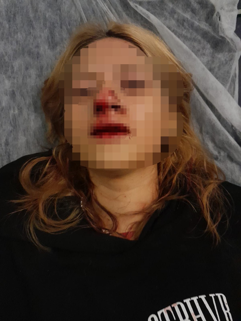 İstanbu'da dehşet! Genç kızın dişlerini kaldırım taşı ile kırdılar, yanındaki erkeğin kulağını kestiler - Resim: 2