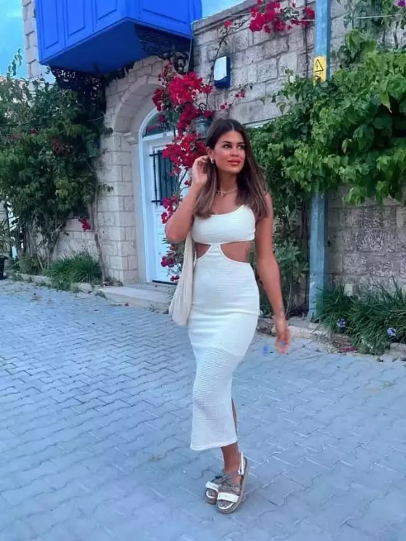 Mali ile evliliği gündem olan Gülseren Ceylan göz kapaklarını aldırdı - Resim: 1