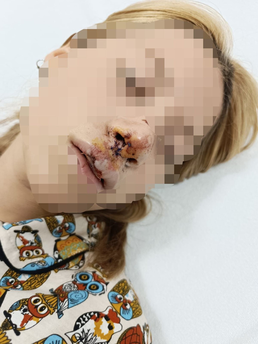 İstanbu'da dehşet! Genç kızın dişlerini kaldırım taşı ile kırdılar, yanındaki erkeğin kulağını kestiler - Resim: 3