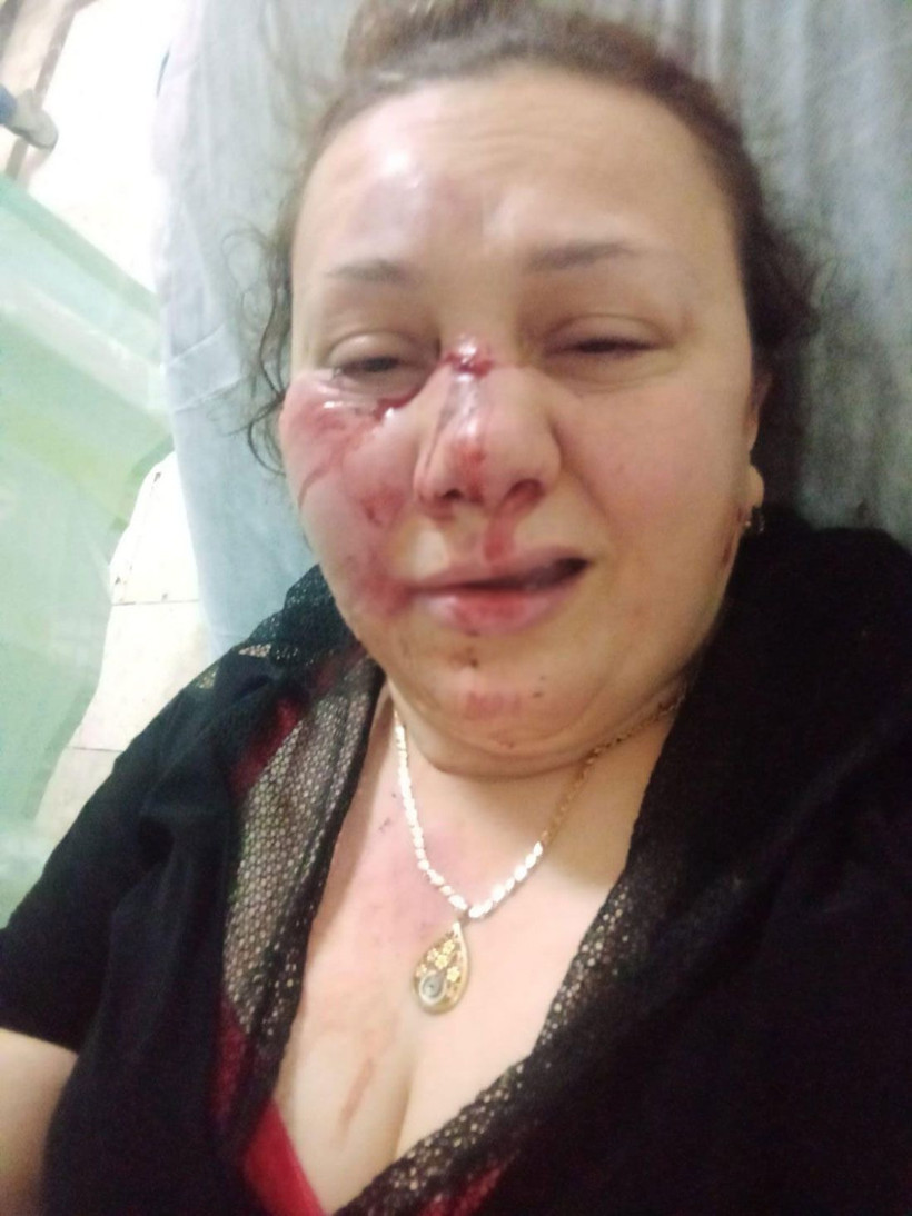 Kanlar içinde gözünü hastanede açtı! Gaziantep'te eski sevgili dehşeti - Resim: 1