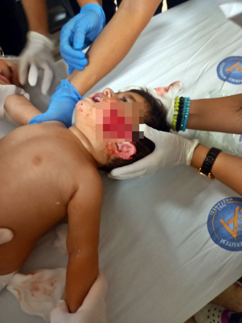 Antalya'da markette korkunç olay! 'Yüzünü komple parçaladı, kulağı sallanıyordu' - Resim: 2