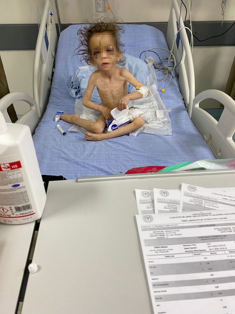 Gaziantep'te cani anne 5 yaşındaki çocuğunu günlerce aç bırakıp işkence etti - Resim: 4