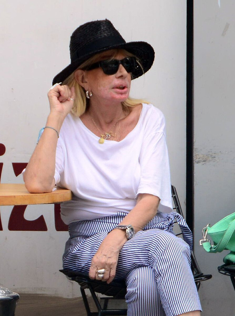 Terlikle oynuyor kimseyi tanımıyor! Pakize Suda'nın son hali yürekleri acıttı: Felaket tellalı duyurdu - Resim: 2