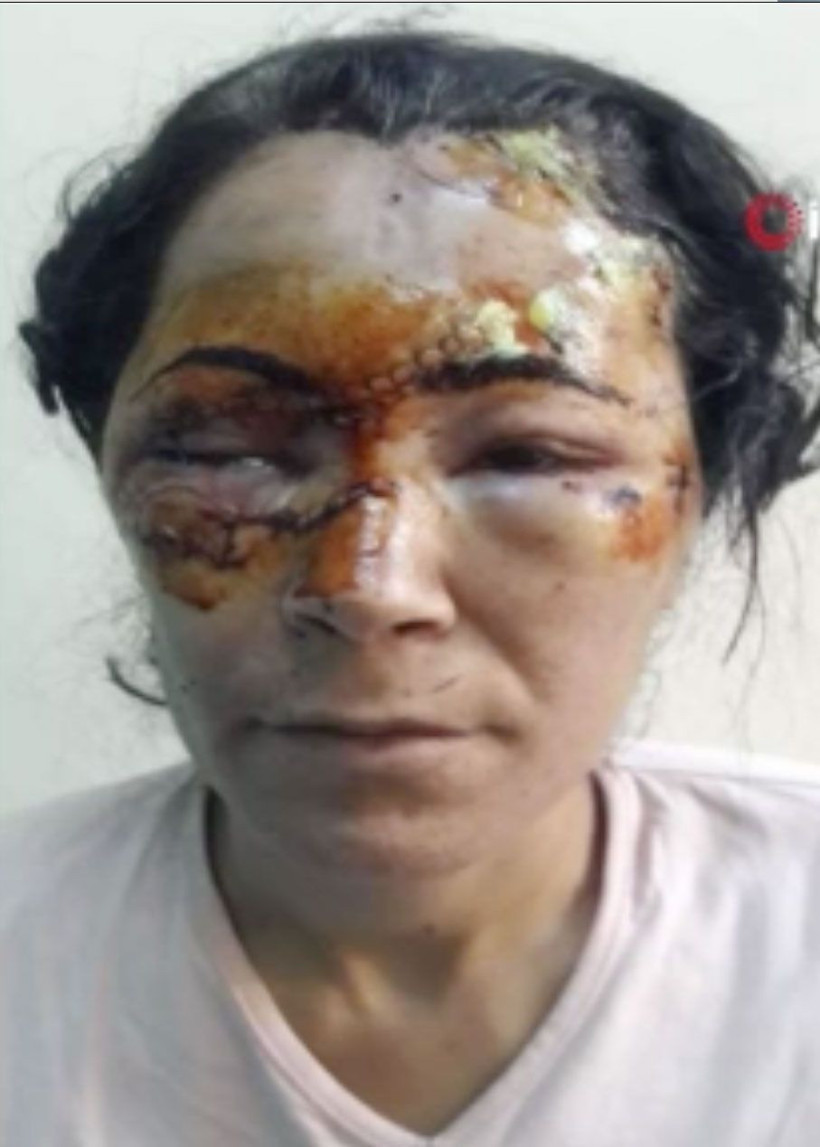 Gaziantep'te cezaevi arkadaşı sevgiliye 7 saat işkence! Uyandığımda tecavüz ediyordu - Resim: 3