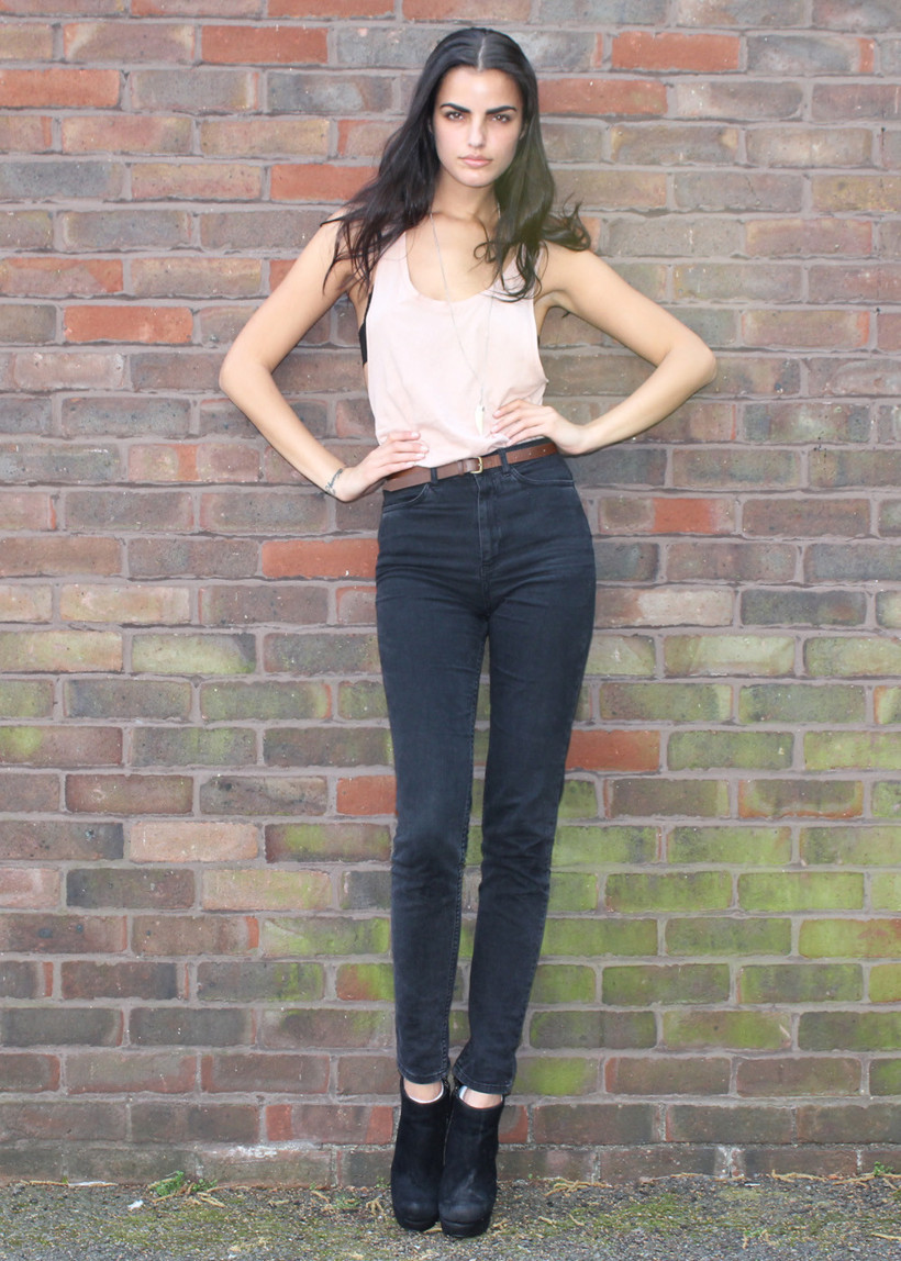 20 fasulyelik diyet az daha öldürüyordu! Son hali  çok şaşırtacak - Resim: 2