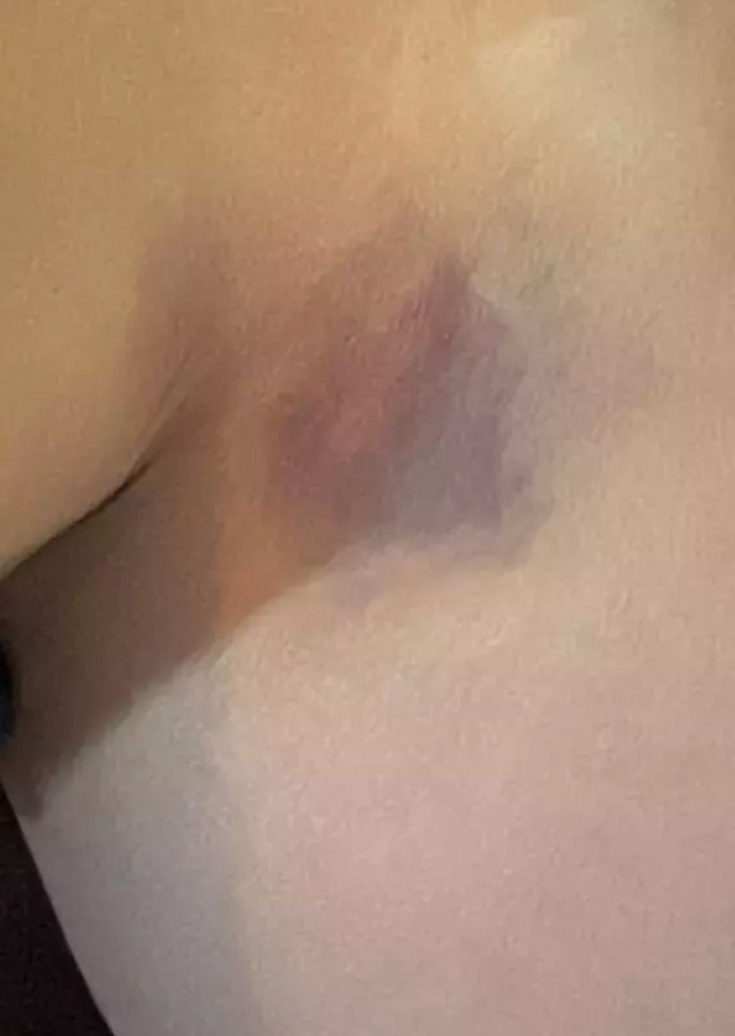 8 ay önce evlenmişti! Yıldız Asyalı eşi tarafından darp edildi fotoğraf paylaştı - Resim: 4