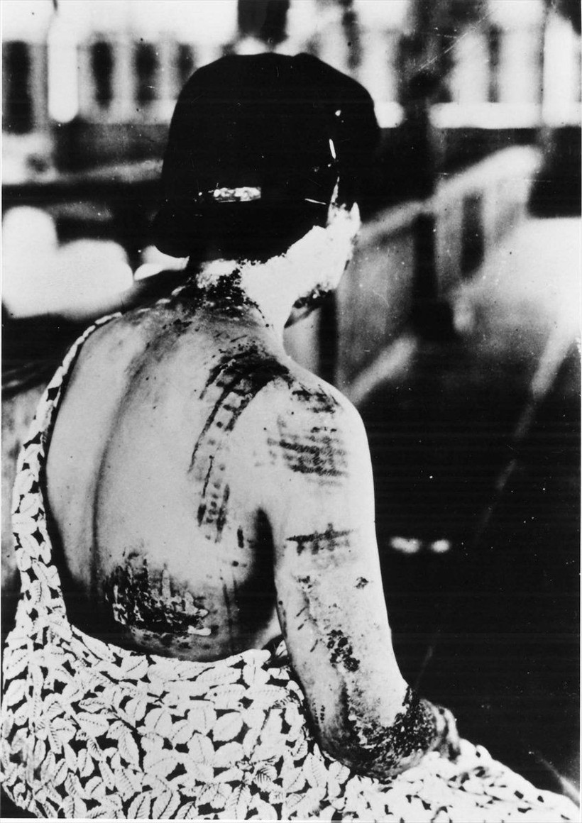 İkinci Dünya Savaşı'nda ABD'nin Hiroşima'ya atom bombası atmasının 77. yılı - Resim: 3