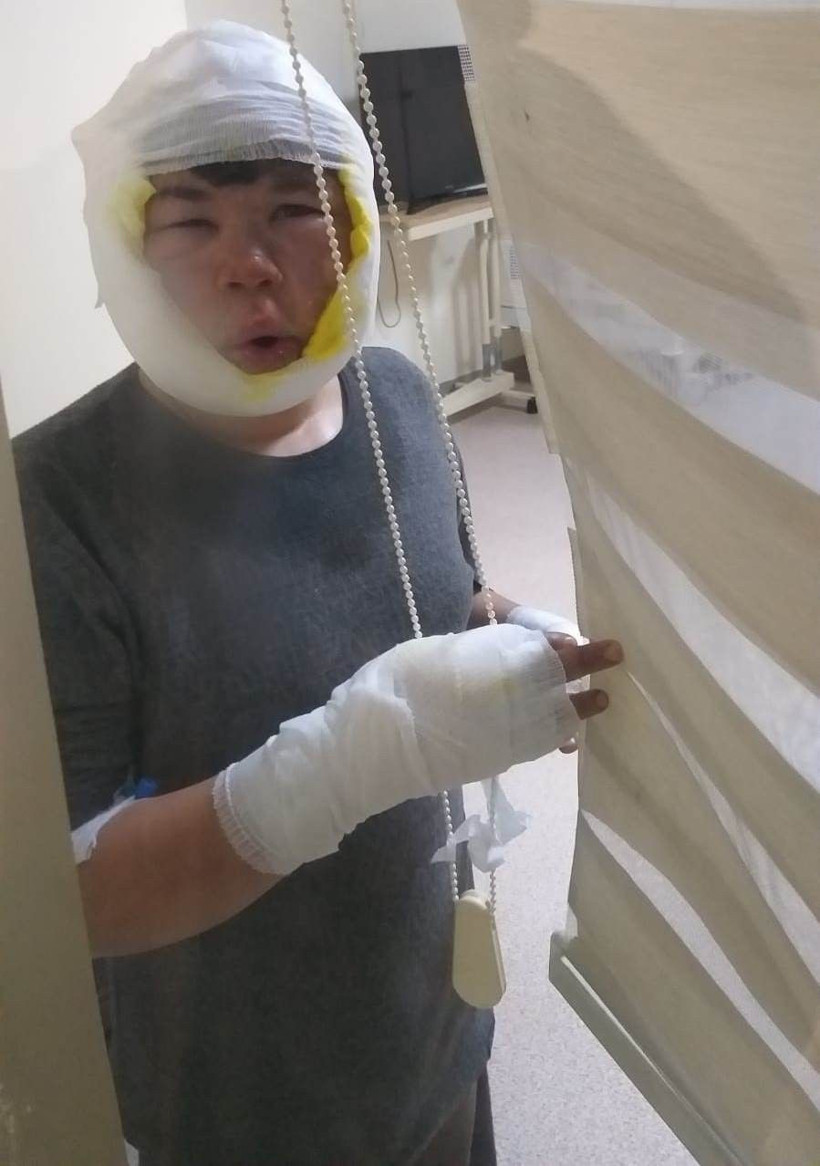 Gaziantep'te oyun korkunç şekilde bitti! Bomba gibi patladı alevler metrelerce yükseldi: Oğlumu tanıyamadım - Resim: 3