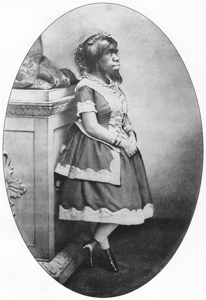 Dünyayı şaşkına çeviren 'maymun kadın' inanılmaz - Resim: 3