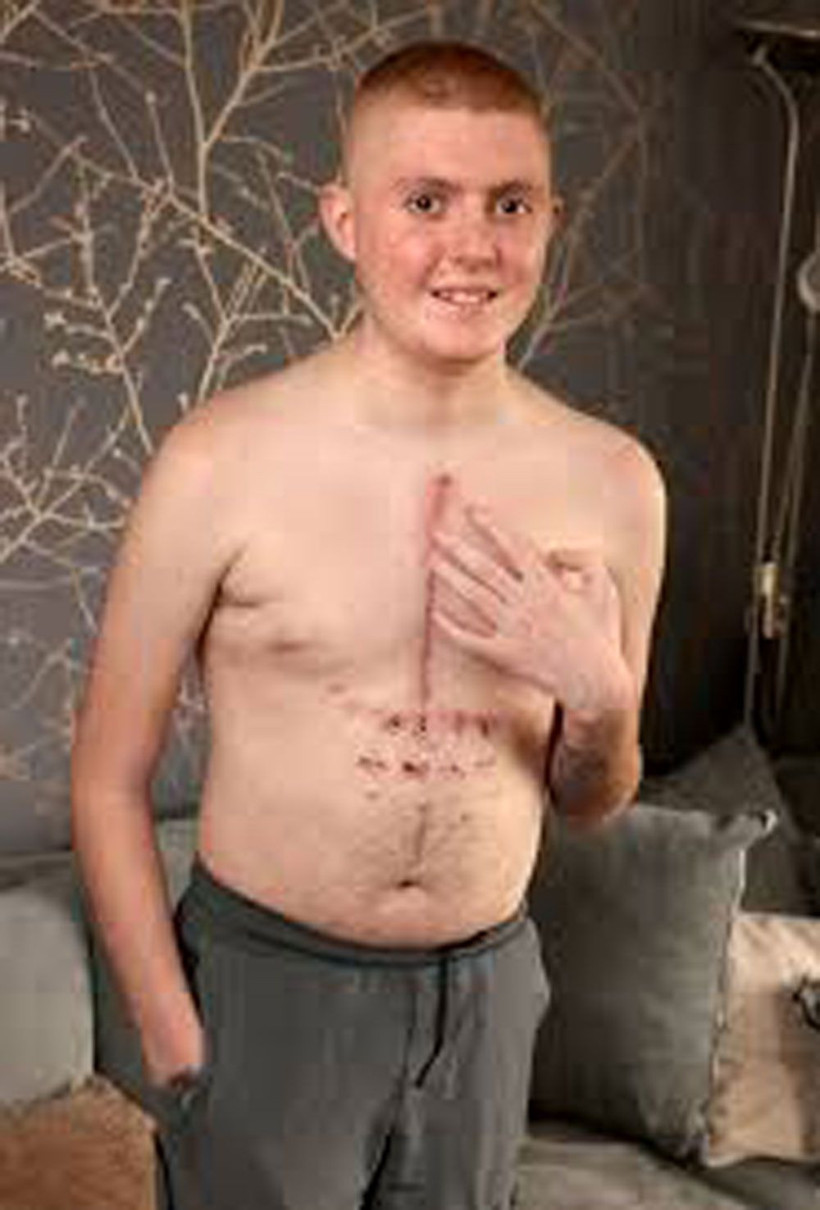 İki kez öldü! Tıp dünyasında eşi benzerine zor rastlanan olay - Resim: 3