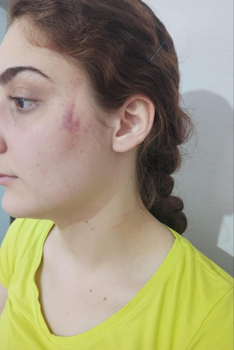 Dayakçı koca, boşanma davası açılınca 1.5 yaşındaki kızını kaçırdı! 3 aydır kızını arıyor - Resim: 3