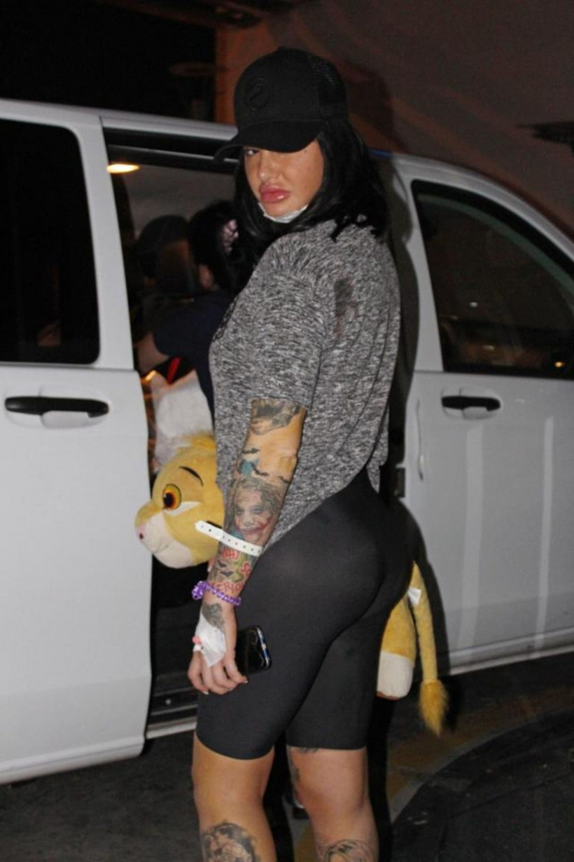 Kalça operasyonu geçirdi, üç hafta oturamayacak! - Resim: 3