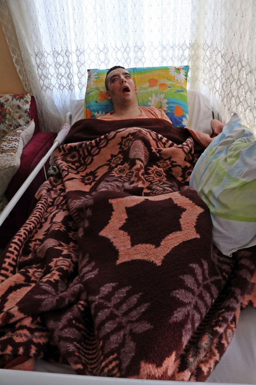 5 yıldır gözlerini kırpamıyor her şey üniversite 2. sınıfta başladı - Resim: 1