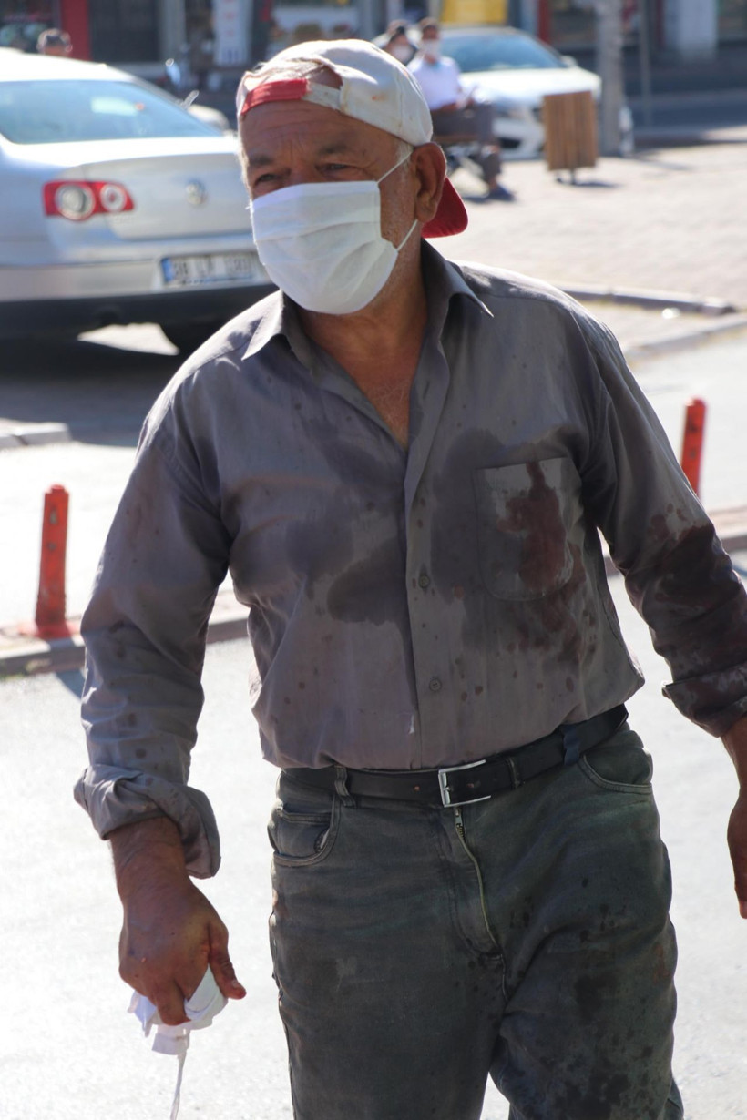 Kurban Bayramı'na acemi kasaplar damga vurdu kendini kesen hastaneye koştu - Resim: 2