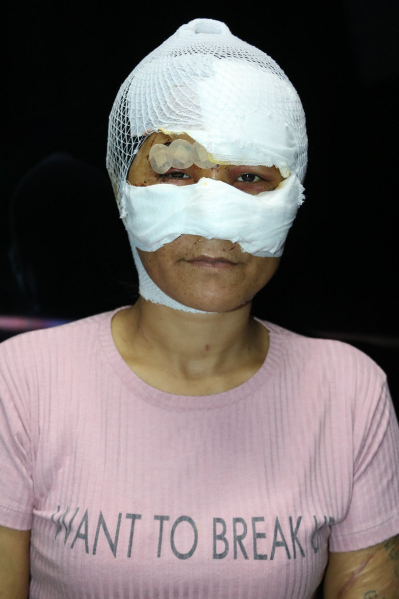 Gaziantep'te sevgili dehşeti! Metruk binaya kapatıp 7 saat işkenceyle tecavüz etti - Resim: 2