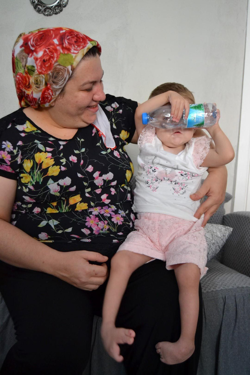 Burun delikleri yok sırtında tümör var Manisa'da Sevgi Hira annesini temasla tanıyor - Resim: 4