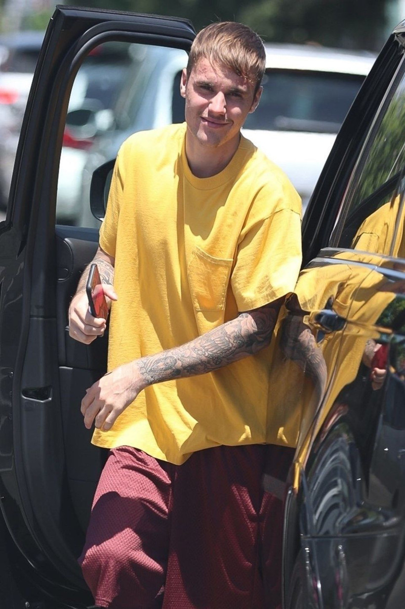 Depresyon tedavisi gören Justin Bieber'ın son hali herkesi korkuttu! Yüzü korkunç - Resim: 3