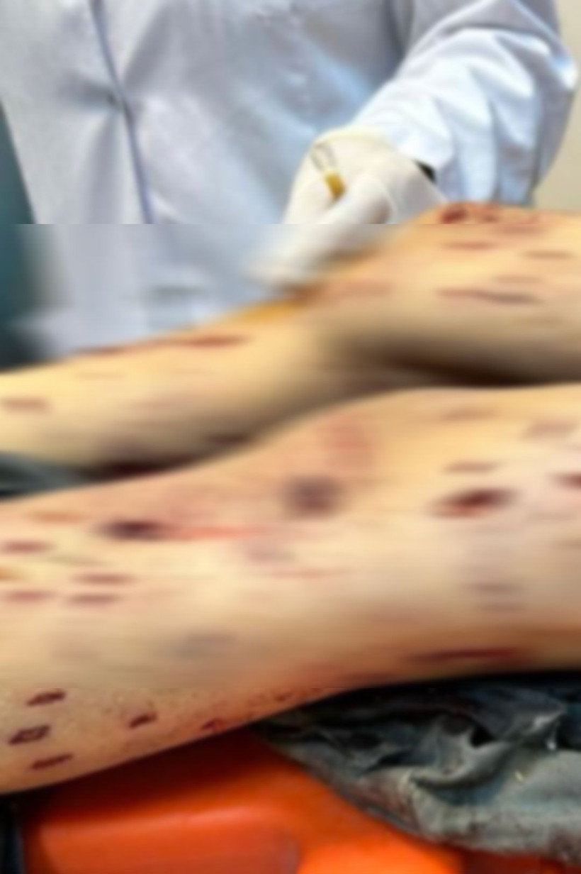 "Vücudunun çoğu yerinde et kalmamış, köpekler yemiş çocuğumu!" Babası Tunahan'ın son durumunu anlattı - Resim: 4