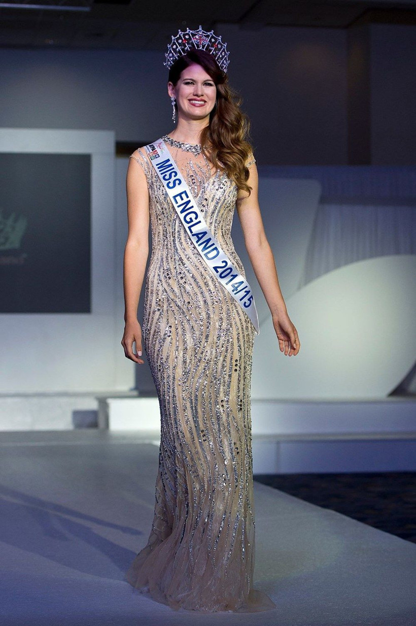 İngiltere'de dünya güzeli dünyayı kurtarıyor! Koronavirüs aşısı geliştiriyor - Resim: 2