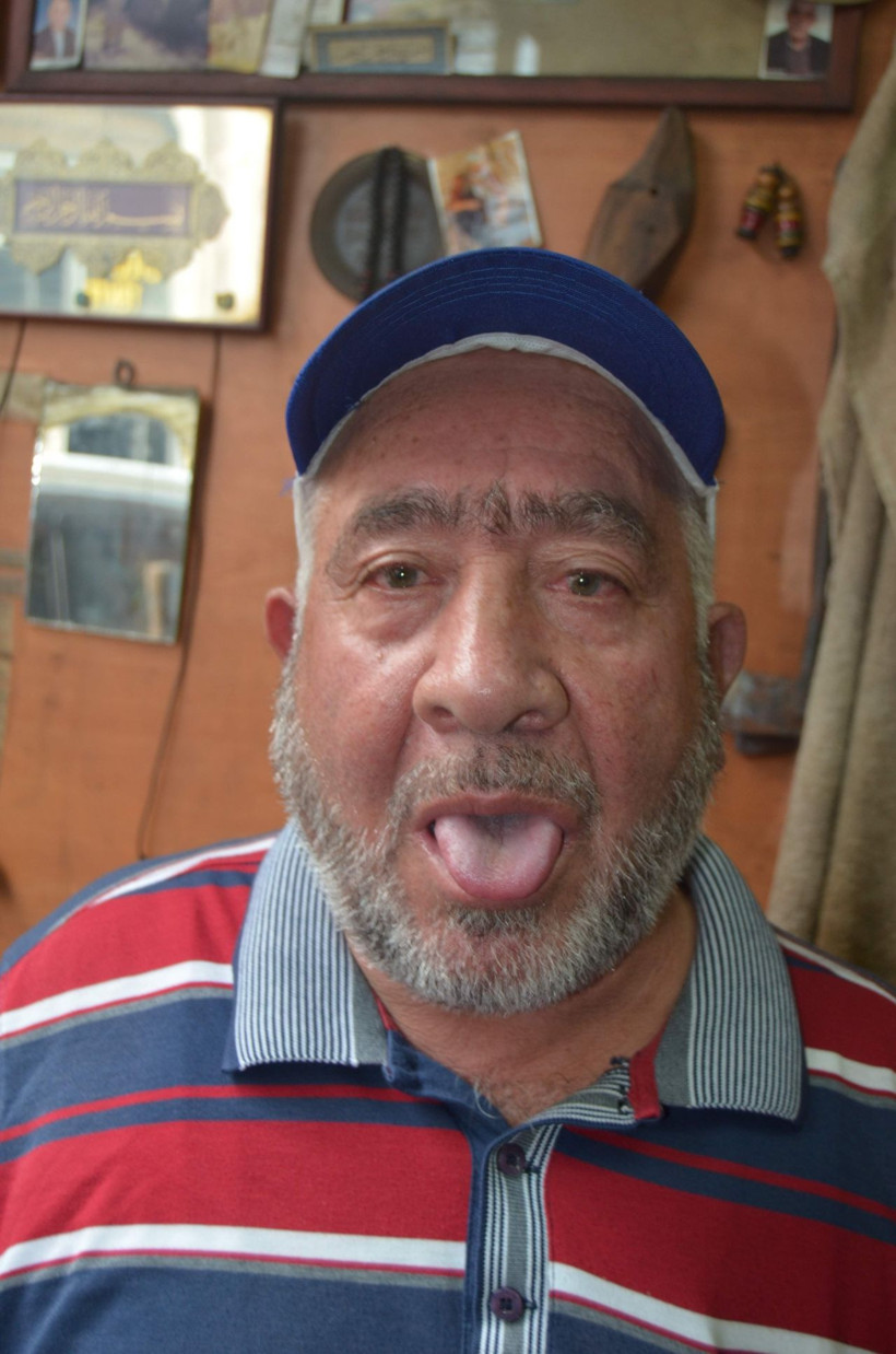 Yaşlı adam 900 derecede kızdırılan demiri yaladı - Resim: 4