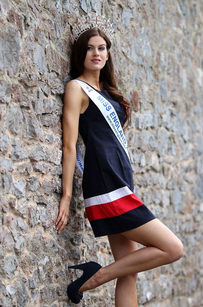 İngiltere'de dünya güzeli dünyayı kurtarıyor! Koronavirüs aşısı geliştiriyor - Resim: 4