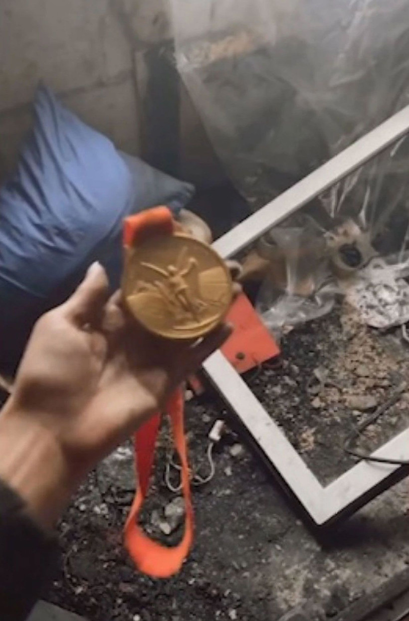 Korona oldu yanarak ölüyordu! Koku duyusunu kaybeden milli jimnastikçi faciadan döndü - Resim: 3