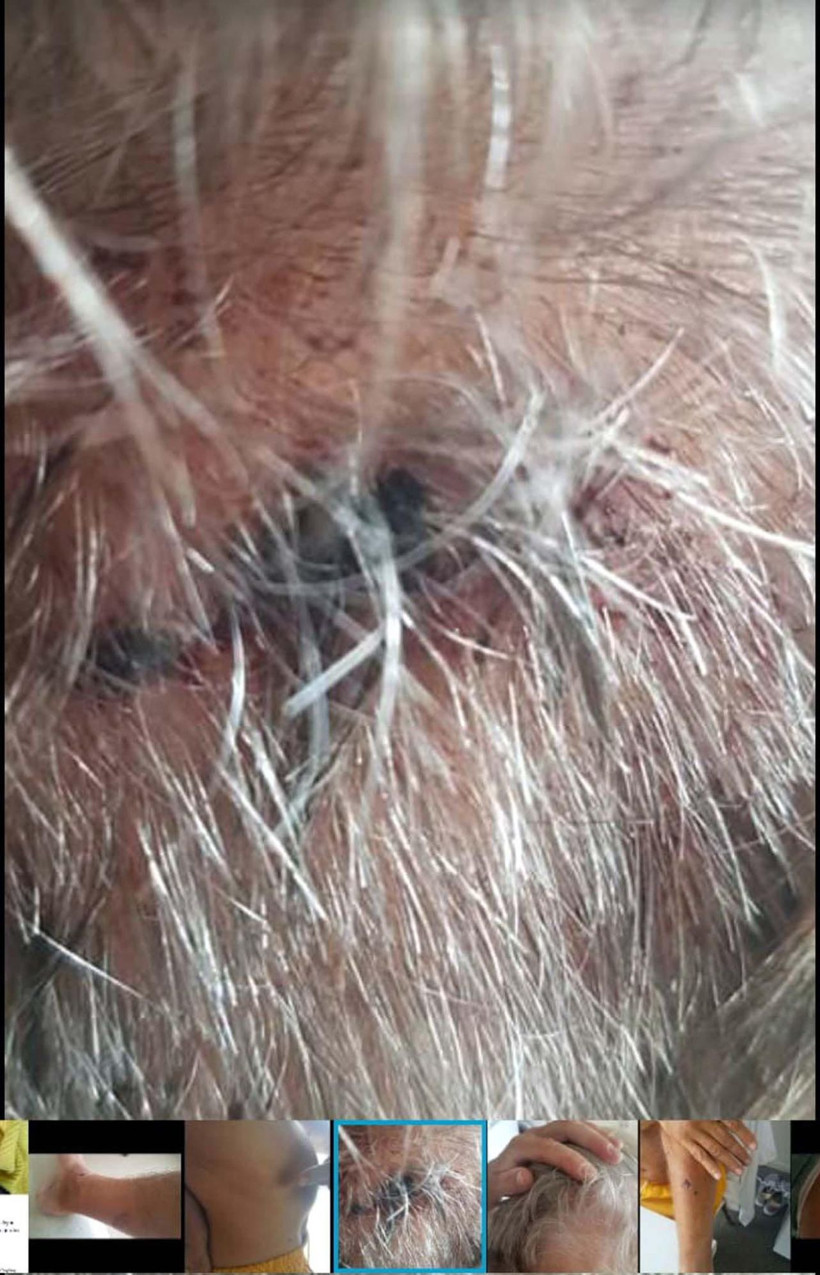 Aydın'da biri felçli İrlandalı çifti 13 yıllık komşuları feci şekilde dövdü - Resim: 2