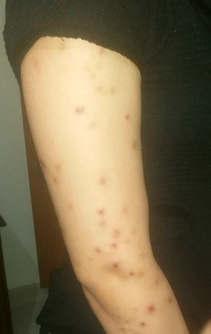 Esenyurt'ta burun estetiği kabusu olan kadının çocuğu: Anne senin burnun yamuk - Resim: 4