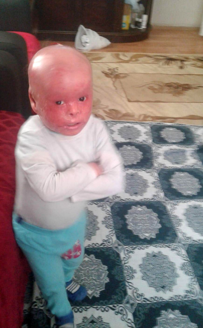 Balık pulu hastası Mehmet Emir'e Haluk Levent'ten büyük destek! - Resim: 2