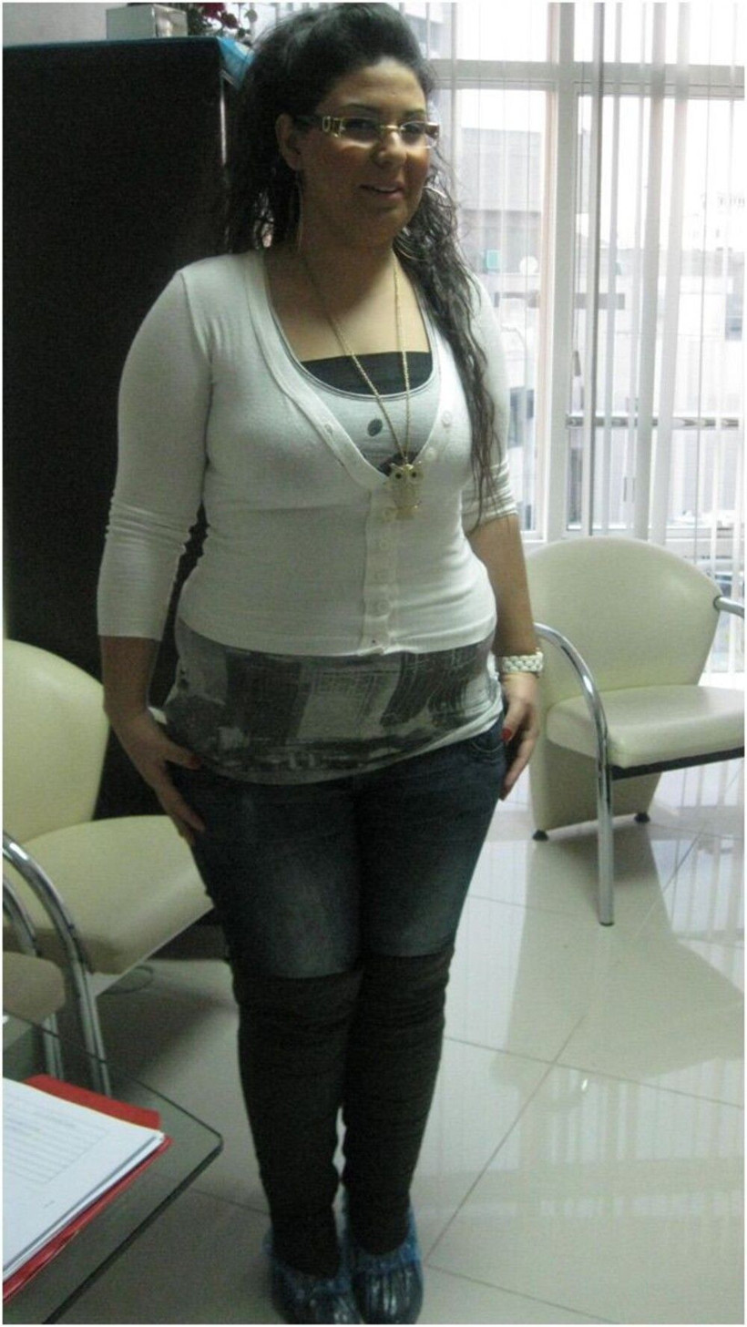 İzmir'de mühendisliği bırakıp diyetisyen oldu! 50 kilo verdi son halini gören şaştı kaldı - Resim: 3