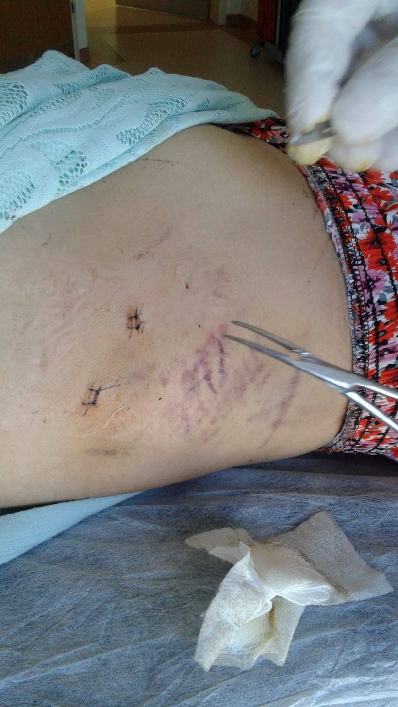 Eskişehir'de eşi Öznur Sazlar'ı 15 yerinden bıçaklayan cani serbest kaldı - Resim: 3