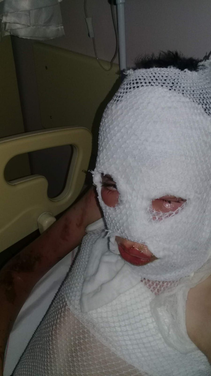 Komşularının üzerine kezzap dökmüştü! Cezası belli oldu - Resim: 4