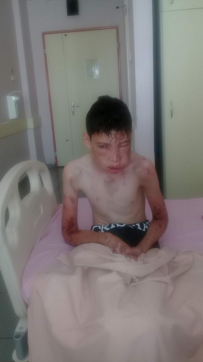 Komşularının üzerine kezzap dökmüştü! Cezası belli oldu - Resim: 3