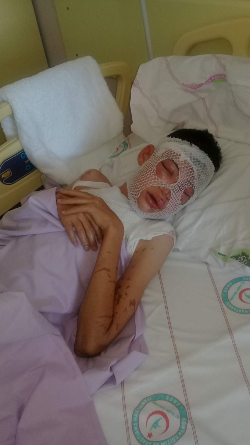 Komşularının üzerine kezzap dökmüştü! Cezası belli oldu - Resim: 2