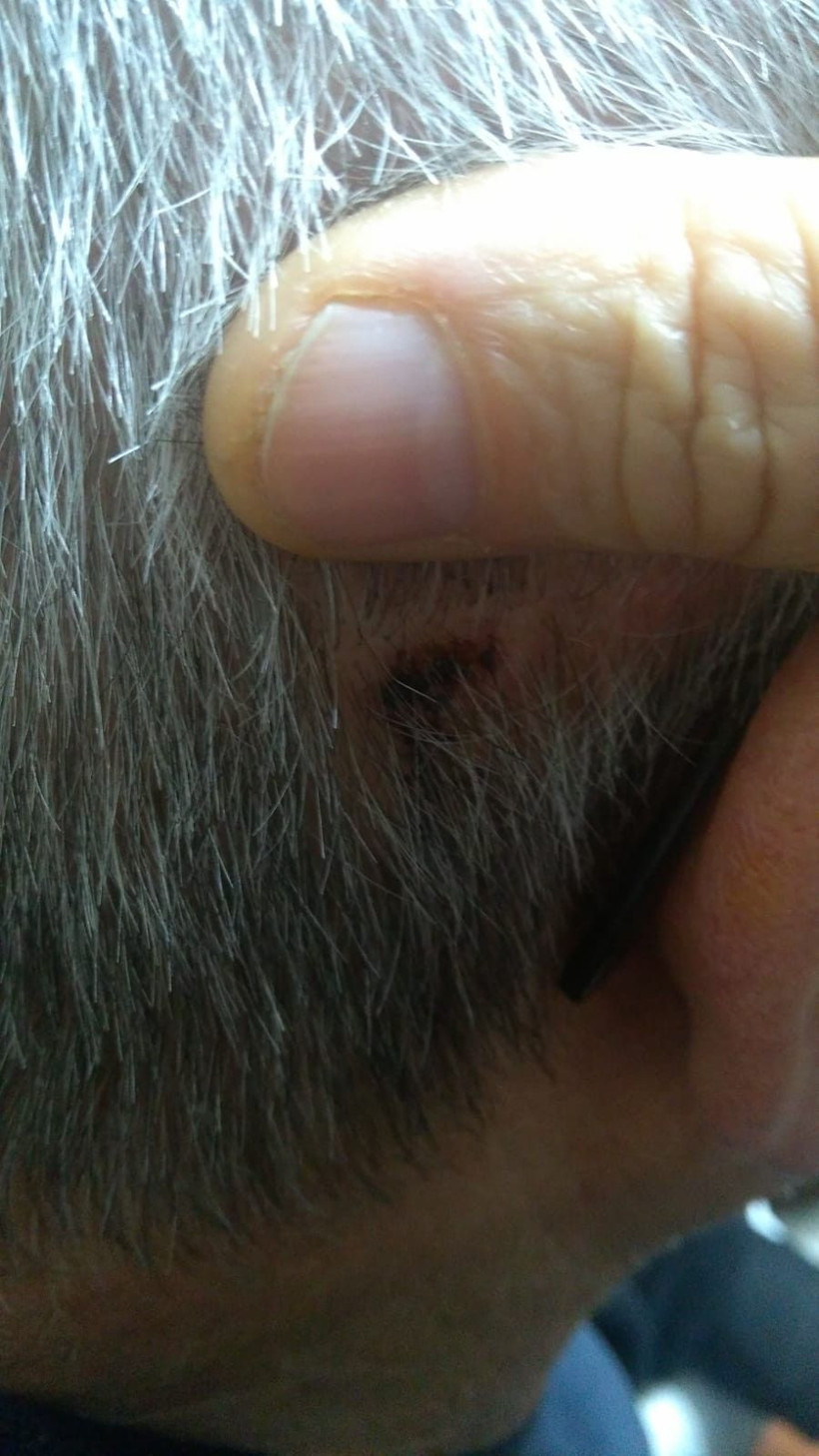 Bursa’da park yüzünden çıkan kavgada yaşlı çifti öldüresiye dövüldü - Resim: 2