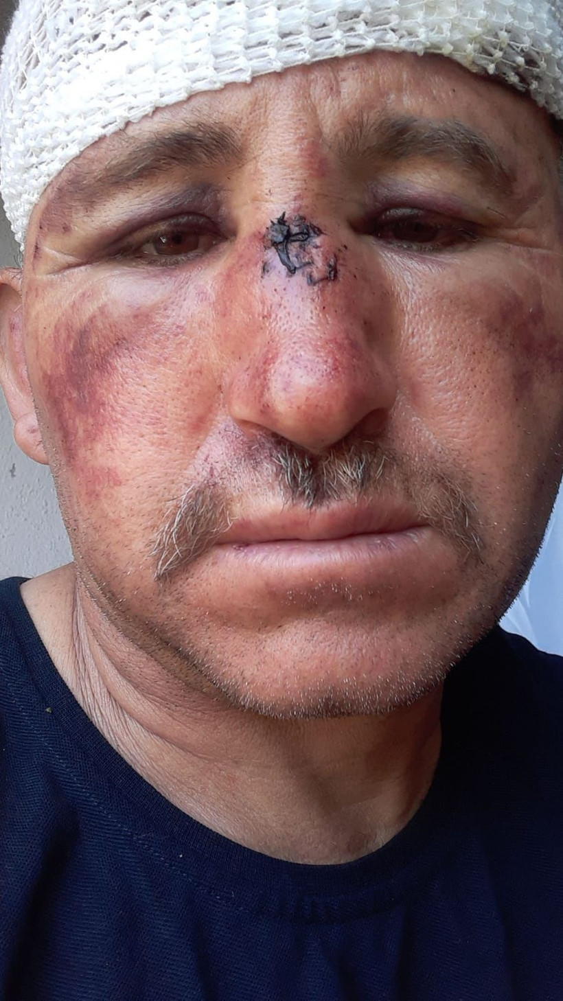 Antalya'da karı-koca tarafından taciz iddiasıyla dayak yiyen adam ilk kez konuştu - Resim: 4