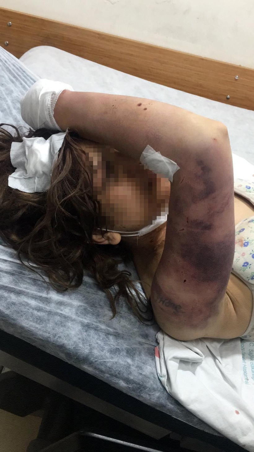 Şanlıurfa'da kan donduran olay! Eşini eve kilitleyip işkence yaptı kerpetenle tırnaklarını söktü - Resim: 4