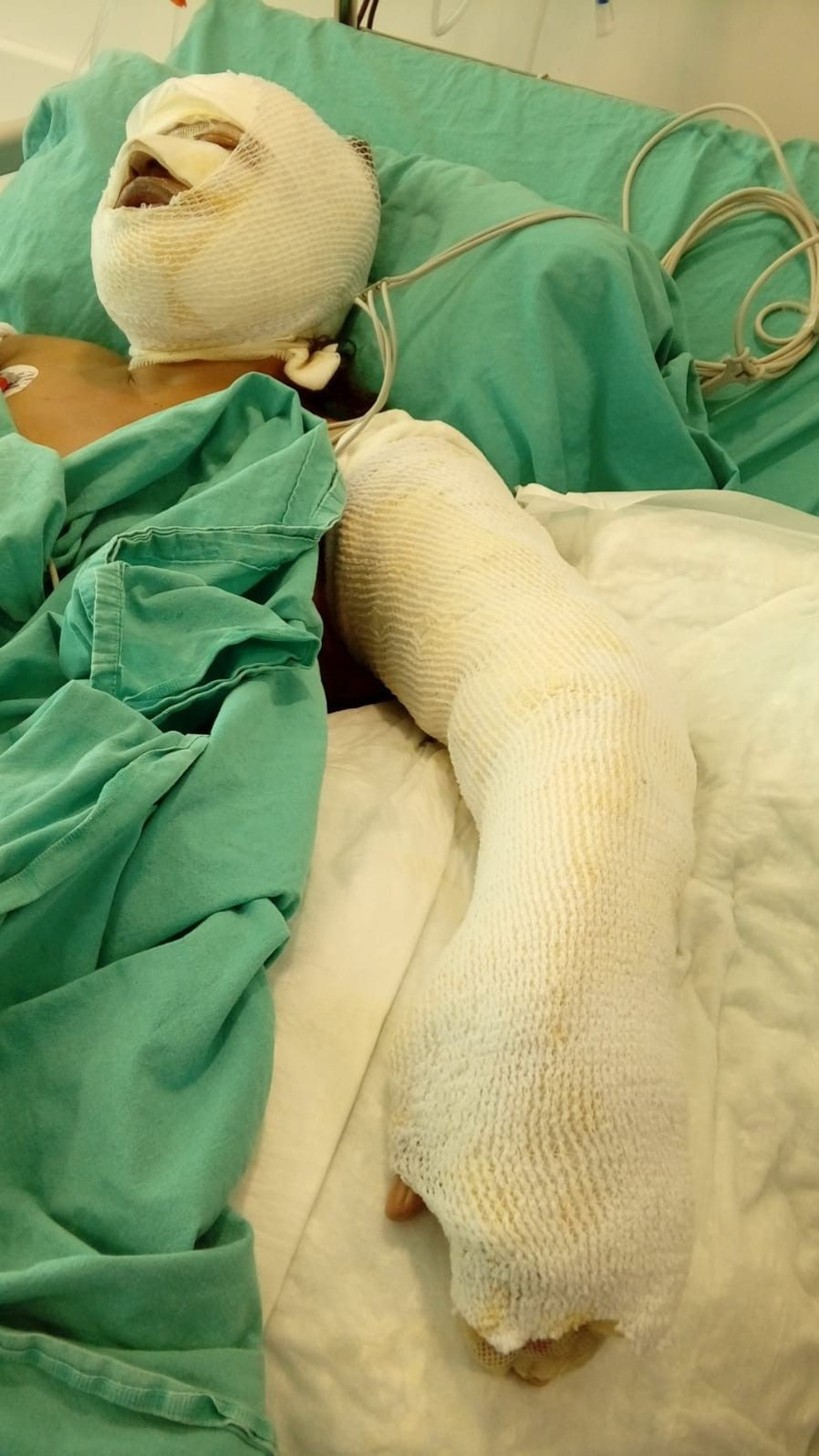 Mersin'de damat üzerine benzin döküp ateşe verdiği kayınvalidesinin alevler içinde yanmasını izledi - Resim: 4